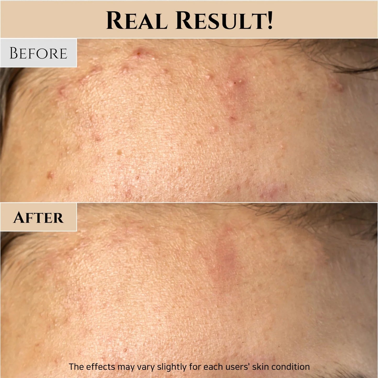 Pore Sebum Care for Dry Sensitive Skin Korean Skin Care 150Ml